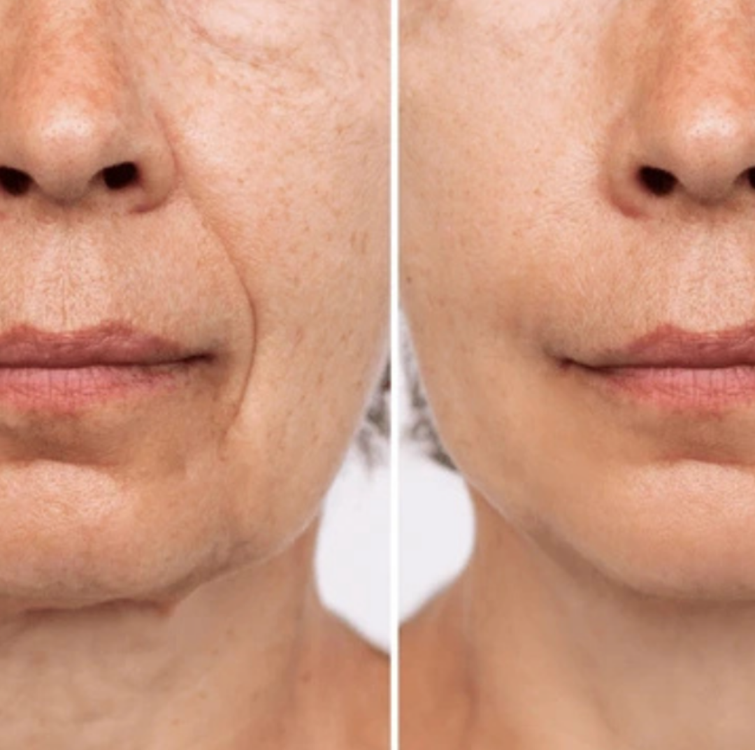 Splashy™ Bio Kolajen Jel Maske